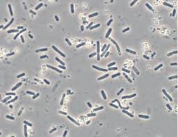 Bacillus_thuringiensis_vi_the